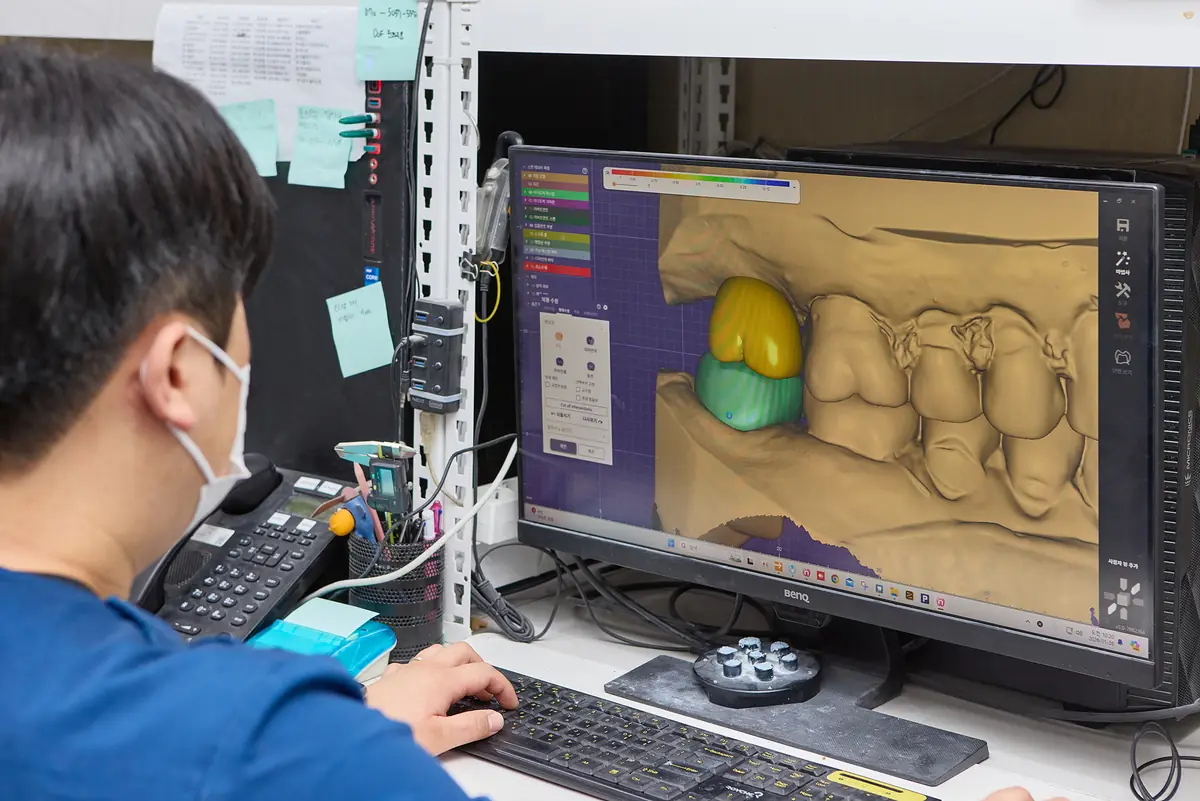 Dental technician designing a ceramic restoration on screen