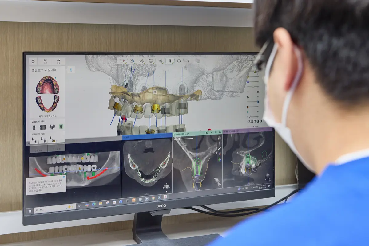 3D implant planning on screen