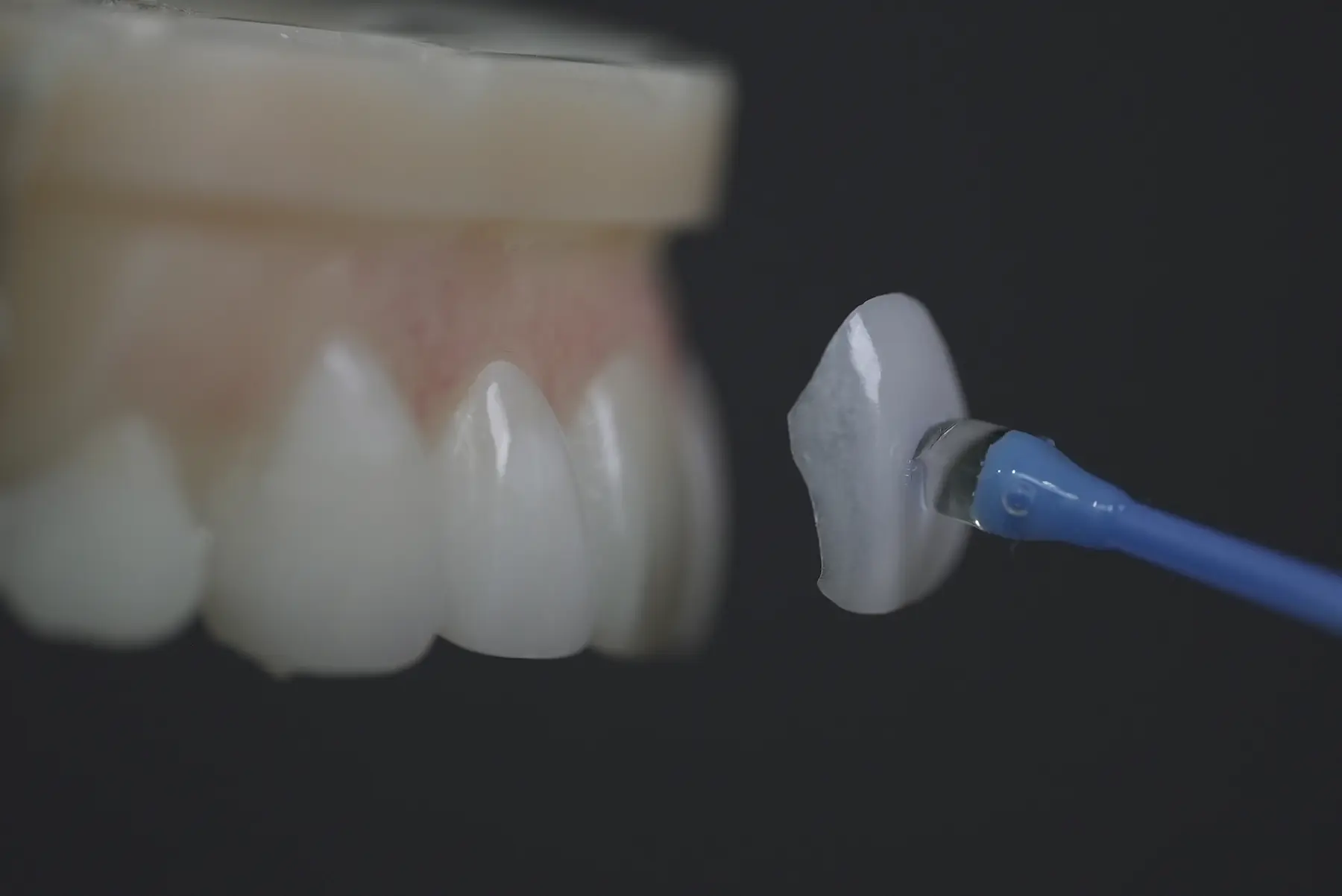 A thin ceramic veneer beside a model of front teeth